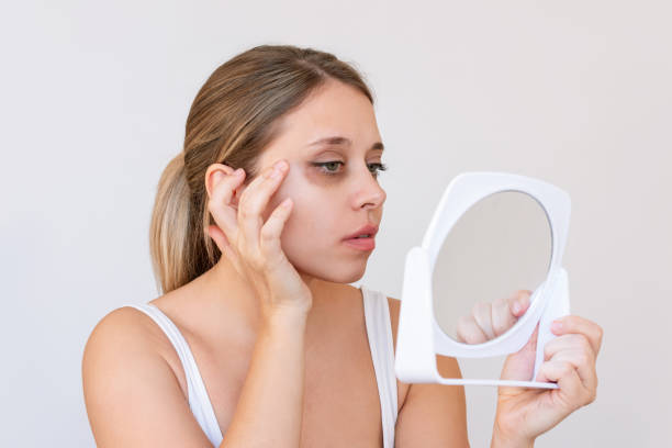 Eye Bag Removal in Riyadh