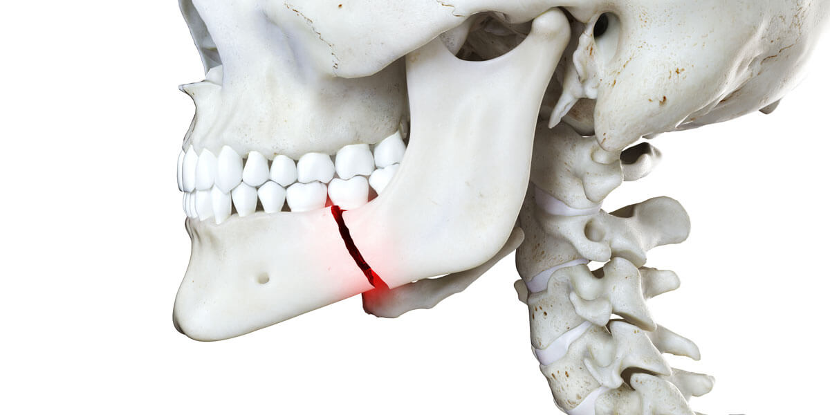 Transform Your Smile and Bite with Orthognathic Surgery