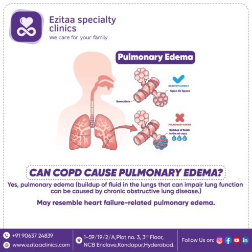 Best Pulmonology Clinic Kondapur – Ezitaa Specialty Clinics