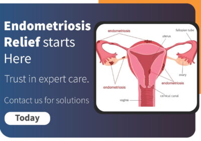 Best-Endometriosis-Treatment-in-Hyderabad
