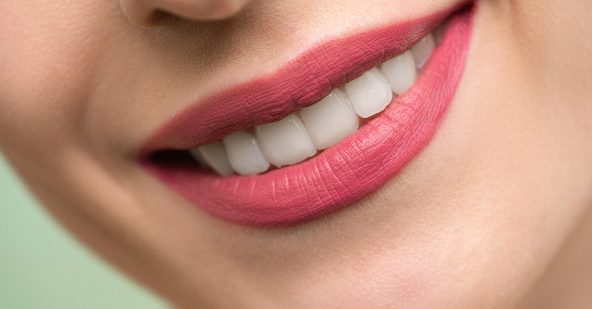 laser teeth whitening near me – MD.co.uk