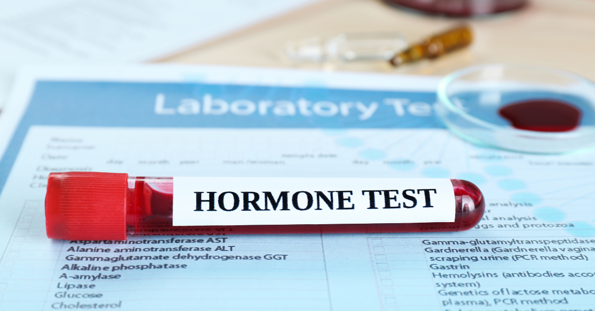 Check Your Hormone Levels with a Male Hormone Profile Test – Only at MD.co.uk