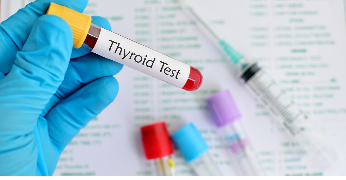 Get Fast & Accurate Thyroid Function Testing in London