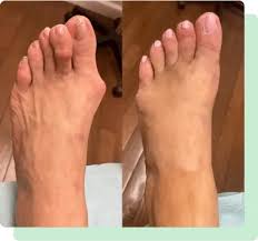 ramospodiatry3