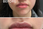 You Aesthetics – Medical Spa