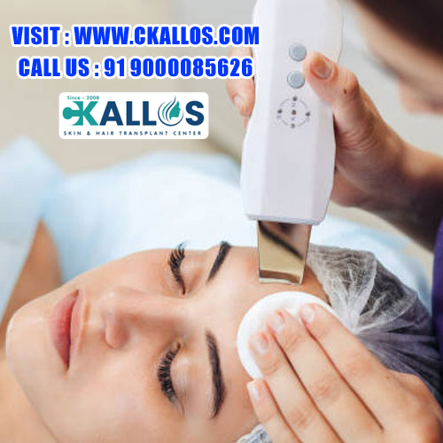 Best Laser Hair Removal Services – Safe & Painless Treatment | www.ckallos.com |