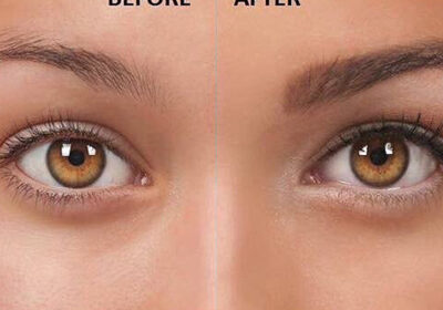 Microblading-Eyebrows-2