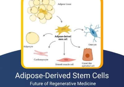 dipose-derived-stem-cells-kosheeka