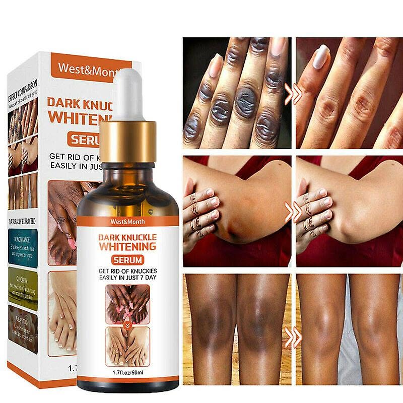 Dark Knuckle Whitening Serum In Fenny Stratford Civil Parish In England, Elbow & Knee Brightening Serum In Kearney City in Missouri Call ☏ +2771 073 2372 Skin Treatment In Polokwane City, Get Rid Of Tattoos And Dark Spots In Montagu Town In South Africa