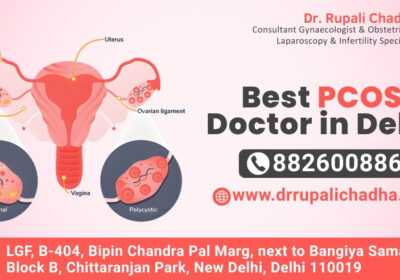 Best-PCOS-Doctor-in-Delhi-1
