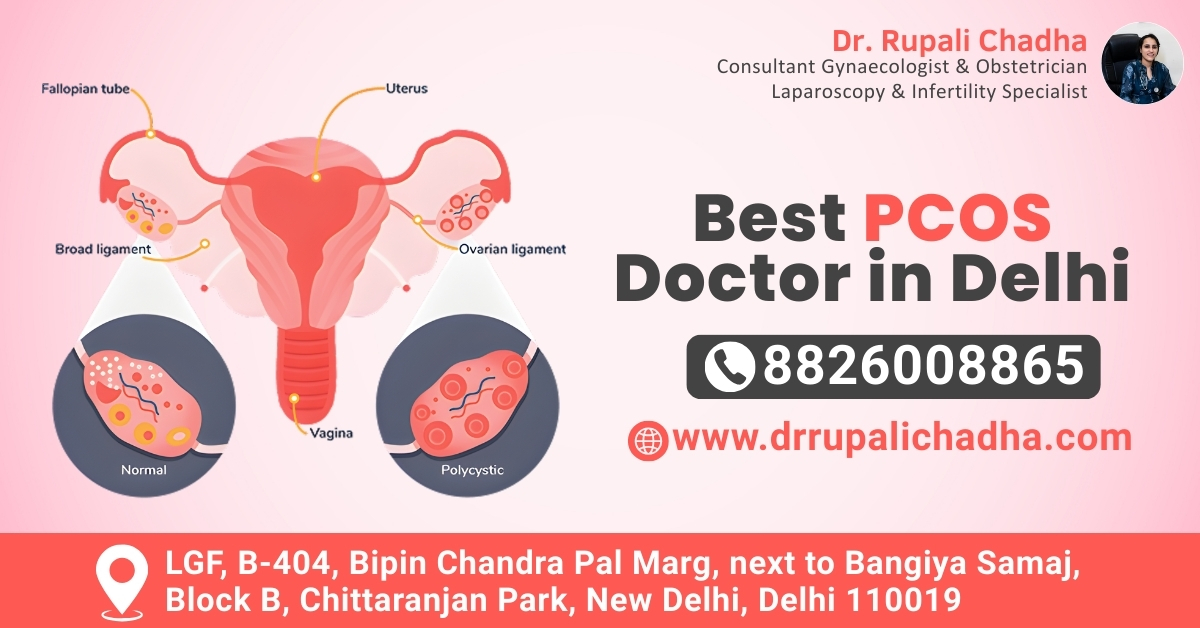 Best PCOS Doctor in Delhi for Lifestyle Balance: Dr. Rupali Chadha