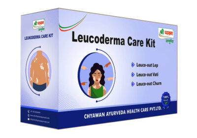 ayurvedic_medicine_for_vitiligo_500x