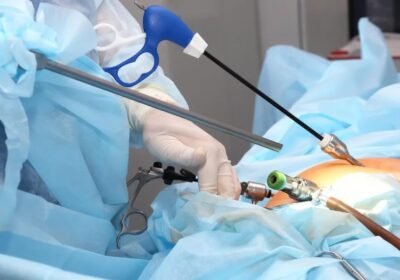 laproscopic-surgery-in-islamabad