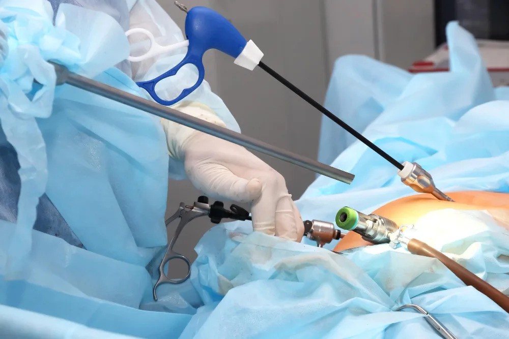 Laparoscopic in Islamabad Pakistan