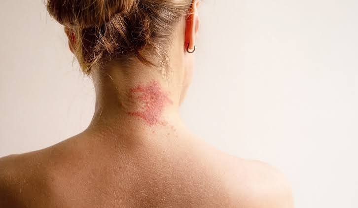 Allergy News